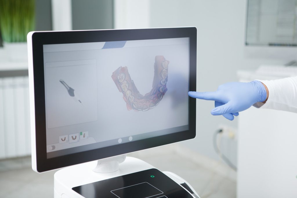 Dentist,Pointing,At,Dental,Scan,On,Computer,Screen