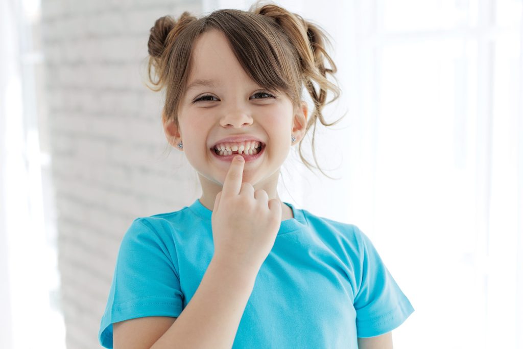 The,Child,Has,Lost,A,Tooth.,Little,Girl,Without,A