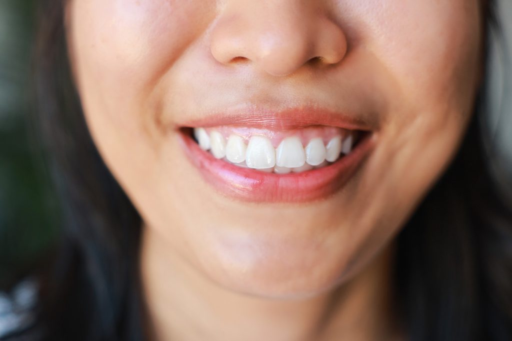Close-up,Of,Perfect,White,Teeth,Smile,Of,A,Young,Asia