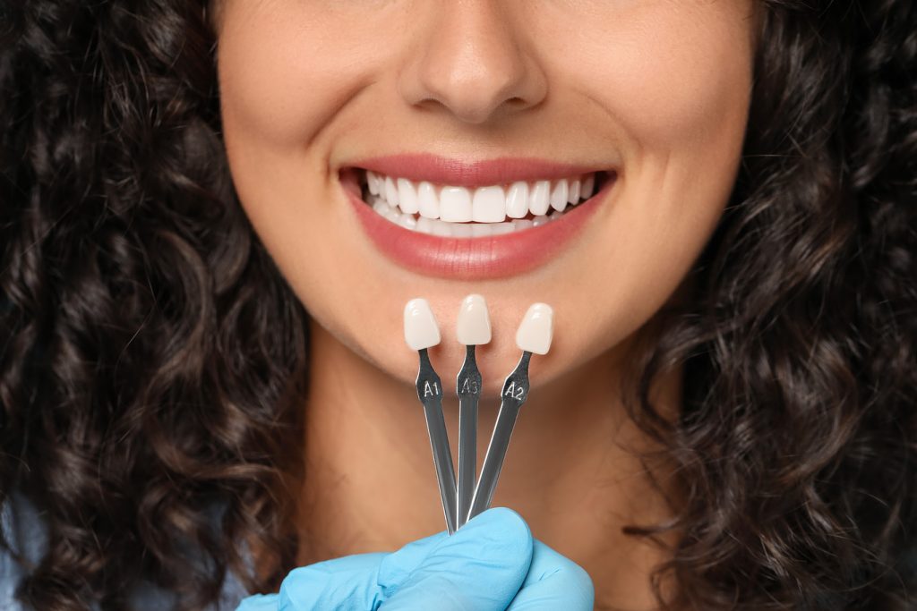 Doctor,Checking,Young,Woman's,Teeth,Color,,Closeup.,Dental,Veneers