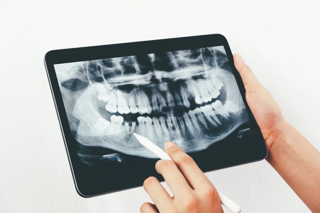 Female,Dentist,Shows,The,Patient,His,X-ray,,The,X-ray,Is