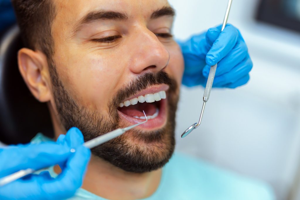 Close-up,Of,A,Man,With,Open,Mouth,During,Dental,Checkup