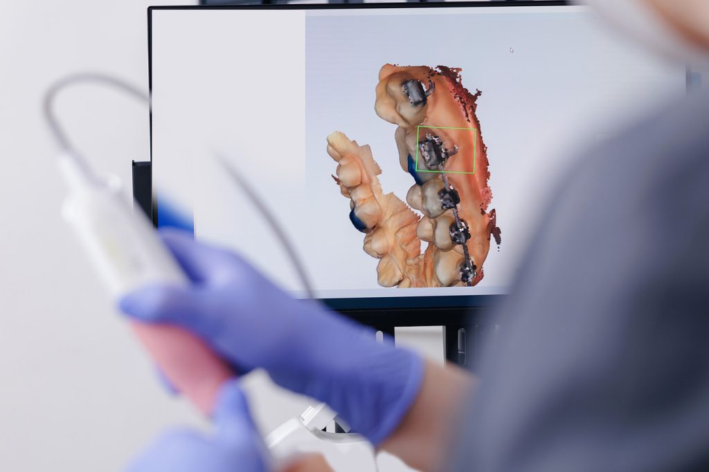 Dentist,Using,Intraoral,3d,Scanner,Of,Jaw,For,Dental,Imaging