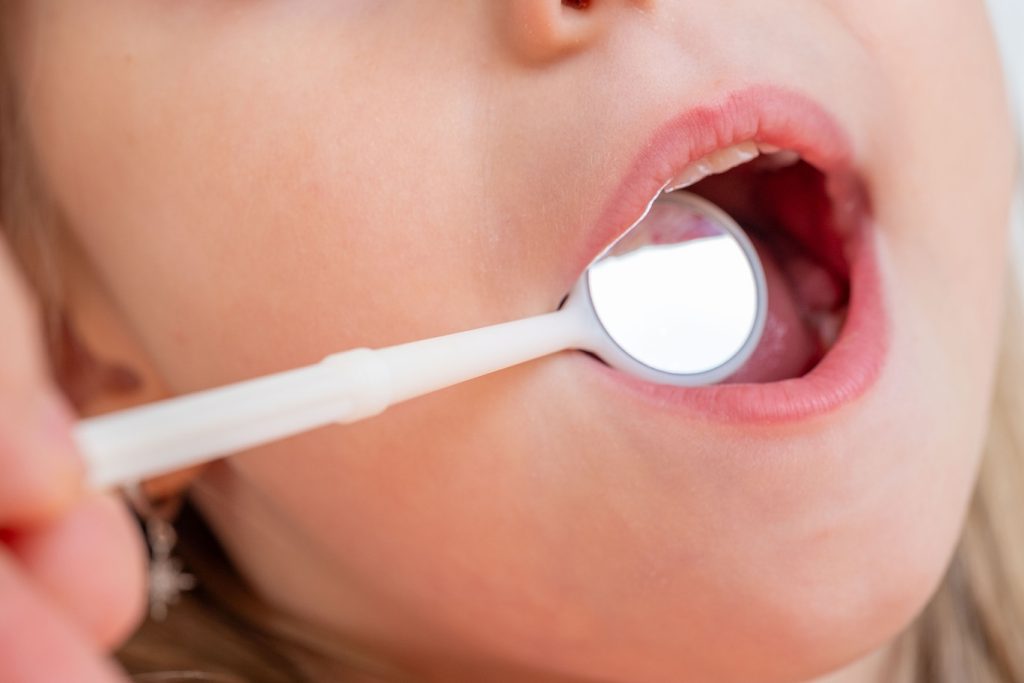 Dentist,,Doctor,Examines,Oral,Cavity,Of,Small,Patient,,Uses,Mouth