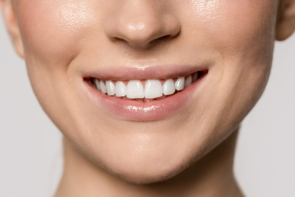 Smiling,Woman,Shows,Her,White,Teeth,With,Natural,Light,In